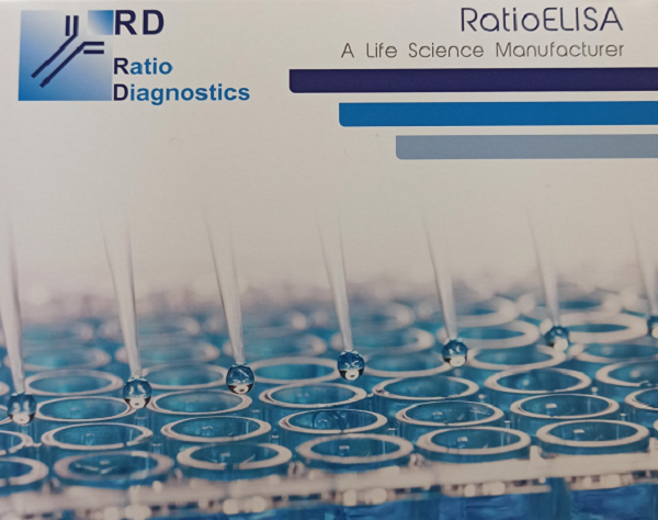 ІФА набір SARS-CoV-2 (COVID-19) IgM RD